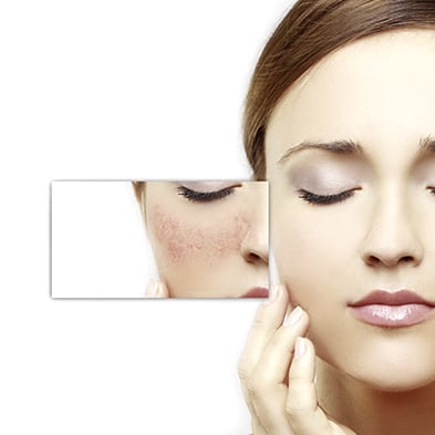 Biodroga MD Anti-Redness Calming Cream